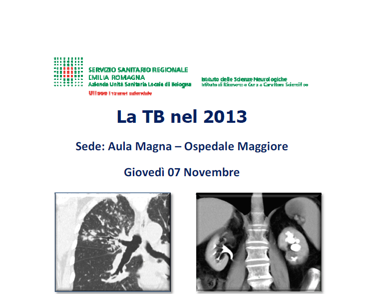 La TB nel 2013